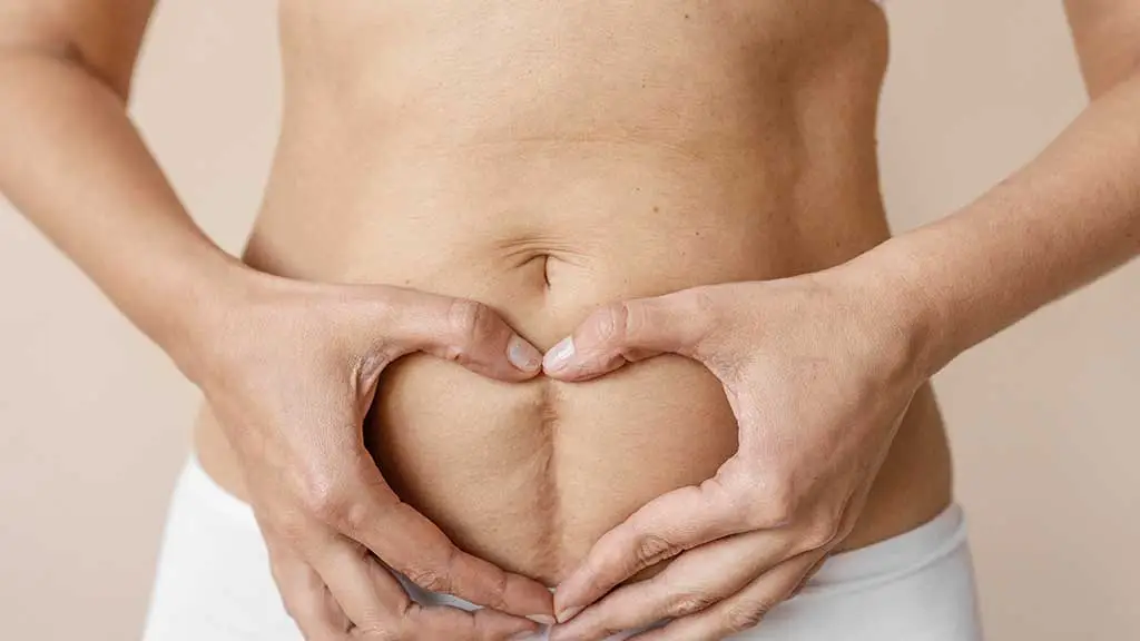 Abdominoplastia vs mini-abdominoplastia